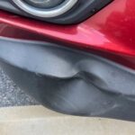 body damage before