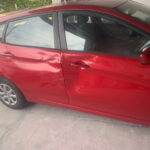 car door dent removal before